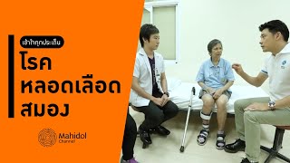 ทำความเข้าใจ โรคหลอดเลือดสมอง