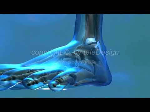 comment soigner rupture ligament cheville