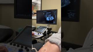 Girl Found Out She’s Pregnant During A School Lab
