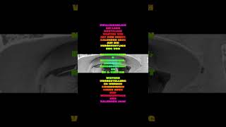 ZwillingsBlick am Lago Bostalsee warten wir mit dem neuen Kalender 2026 auf die Veröffentlichung von Nachkriegskind - Erinnerungen, Gedanken , Kurzgeschichten - Er & sein Ich - weitere Vorbestellung werden angenommen - Neues Buch mit Weihnachtsgoody Kalen