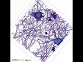 Rat Hippocampal Neurons Imaged With Label Free Live Cell Microscope In 3D