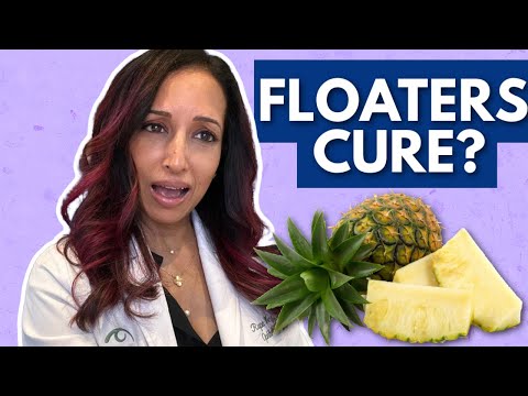 Natural Cure For Eye Floaters? Eye Doctor Explains