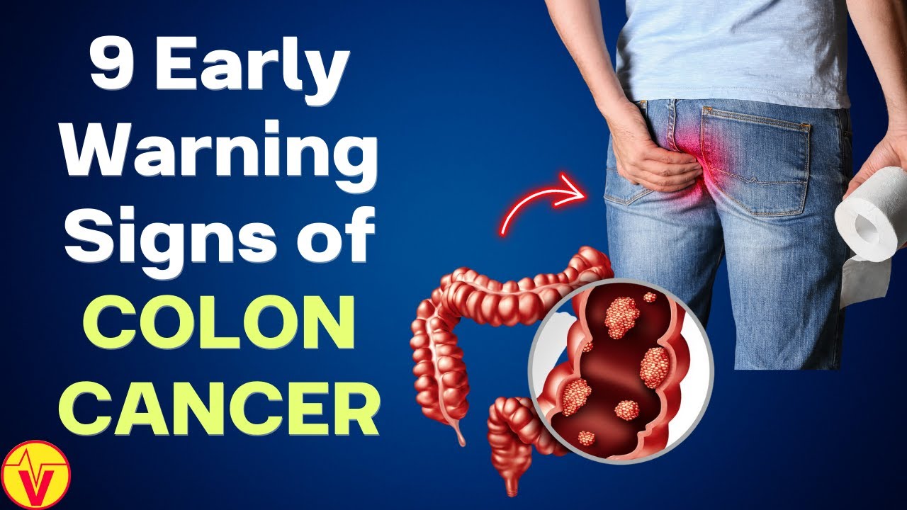 9 Signs and Symptoms of Colon Cancer | Colorectal Cancer Warning Signs | VisitJoy