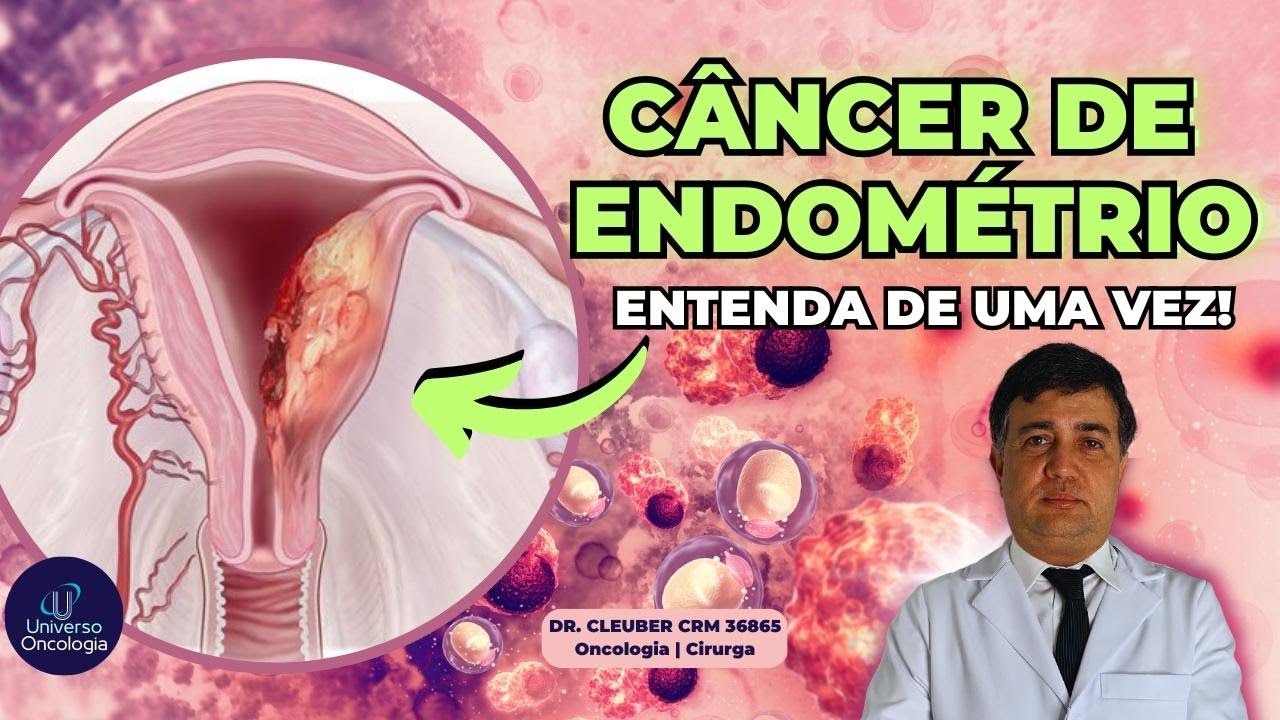 CÂNCER DE ENDOMÉTRIO: Sintomas e Tratamentos  👵🏻 👩🏽‍🦰 👩🏿‍💼