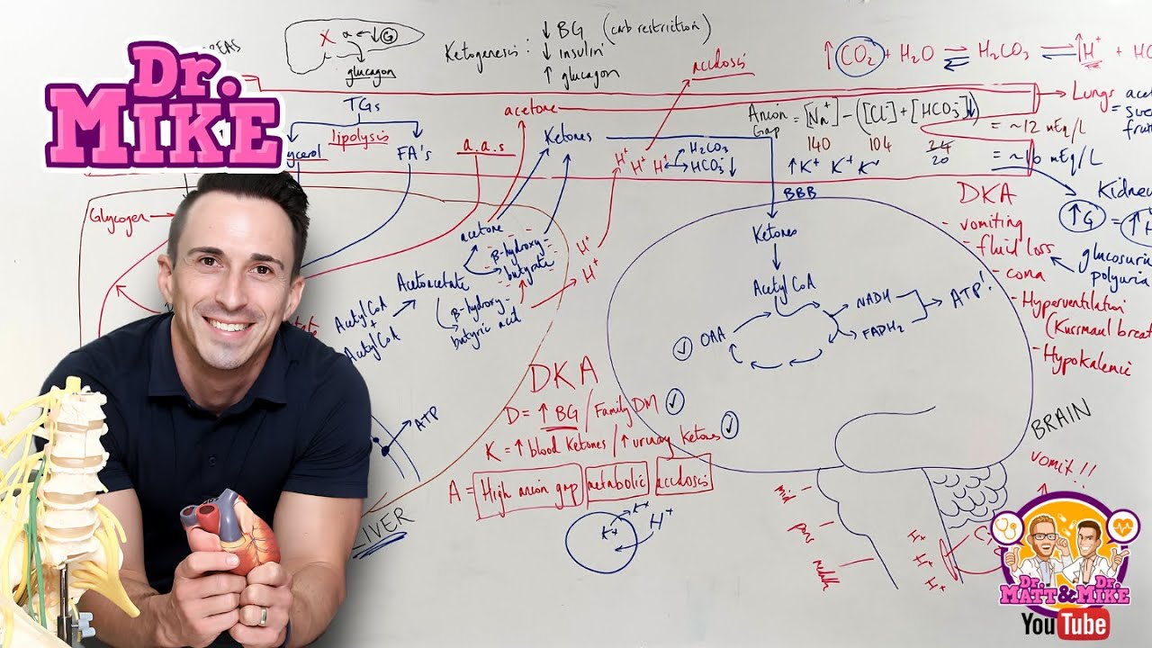 Ketogenesis & Diabetic Ketoacidosis (DKA)
