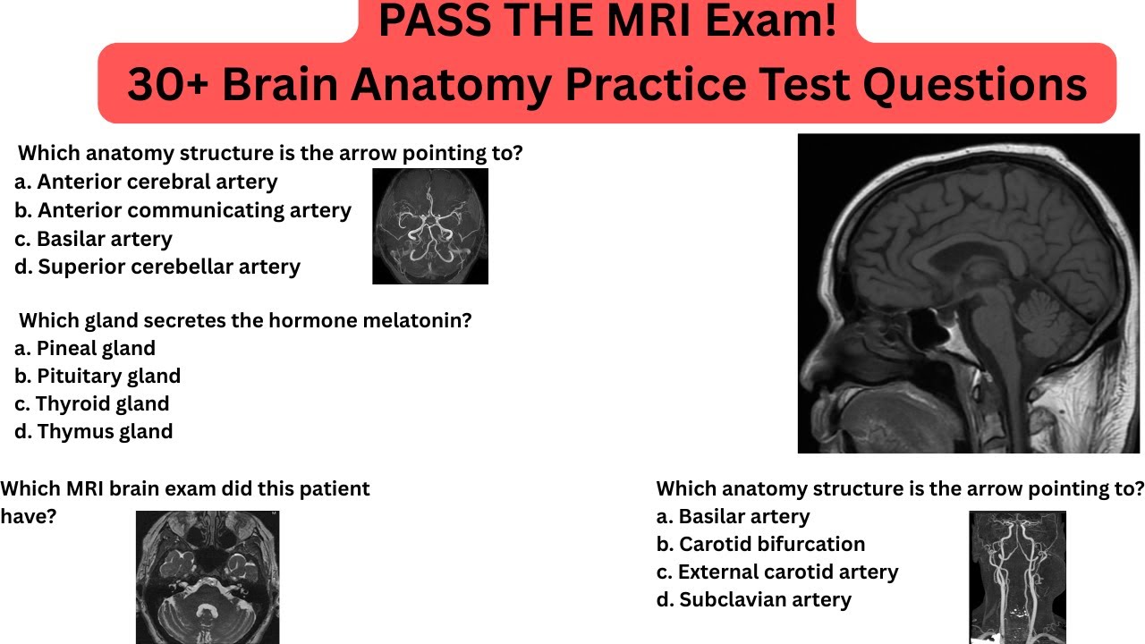 MRI Brain Anatomy Practice Test | 30 Questions & Answers for ARRT & ARMRIT Registry Exam Prep