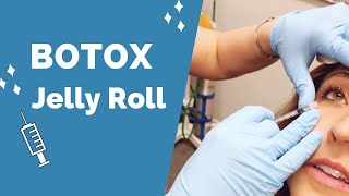 Jelly Rolls | Botox in the Under Eye