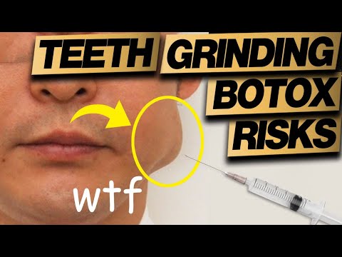 Botox Gone Wrong: Teeth Grinding / Bruxism Risks Explained