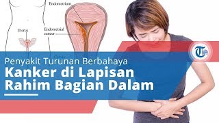 Penyakit Kanker Endometrium, Penyakit Kanker Lapisan Dalam Rahim