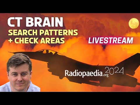 Brain CT: search patterns and check areas with Andrew Dixon