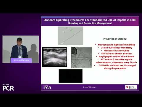 Tailored support for complex PCI and AMI with percutaneous mechanical circulatory support