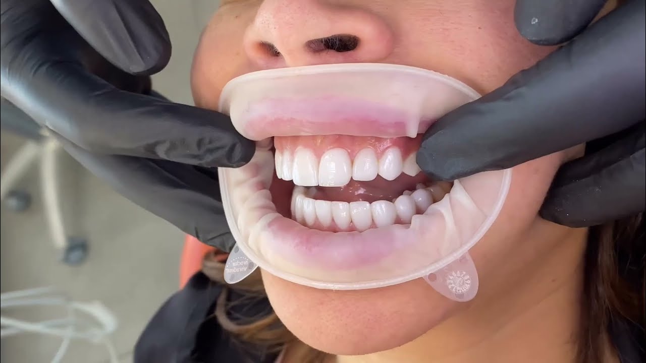 Juan Carlos Hernández Tobón-8