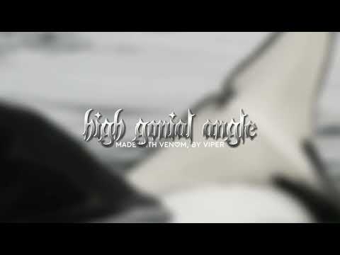 High Gonial Angle