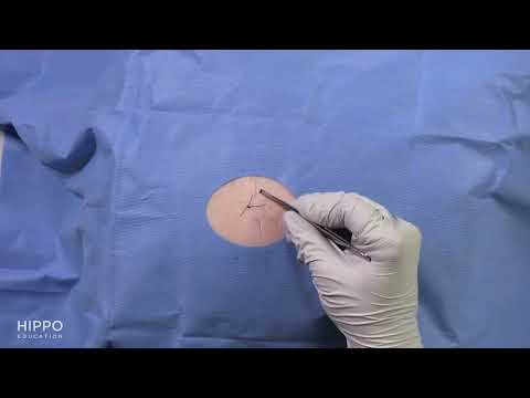 Simple Interrupted Sutures