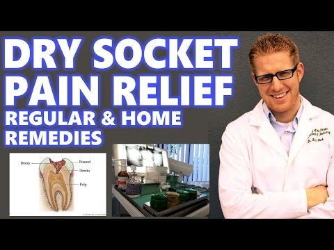 Dry Socket Treatment: Home Remedies Relief Pain After Tooth Extraction Wisdom Teeth Symptoms My Why