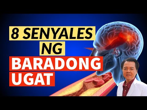 8 Senyales na Barado ang Ugat at Daloy ng Dugo. (Re-edited and Reposted Video)