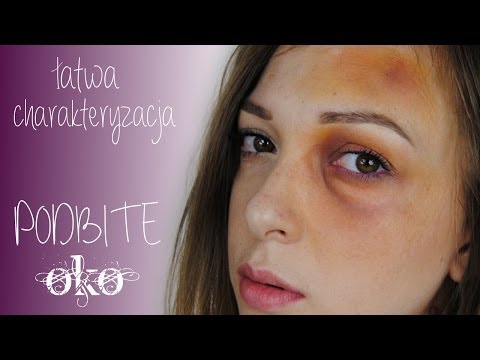 Plano koślawa deformacja znaki stop Rehabilitacja po zabiegu koślawego