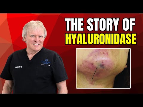 The Story of Hyaluronidase by Prof Patrick Treacy