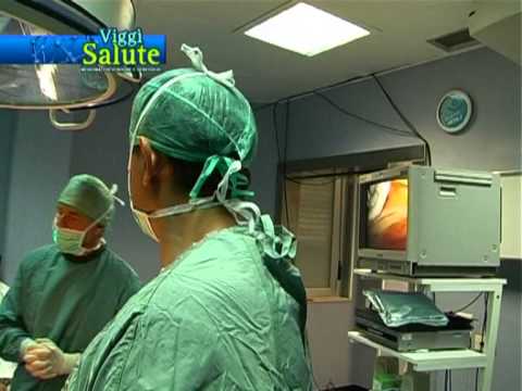 Chirurgia sulla spalla Mosca articolazione Unguento antinfiammatorio per dolore al ginocchio