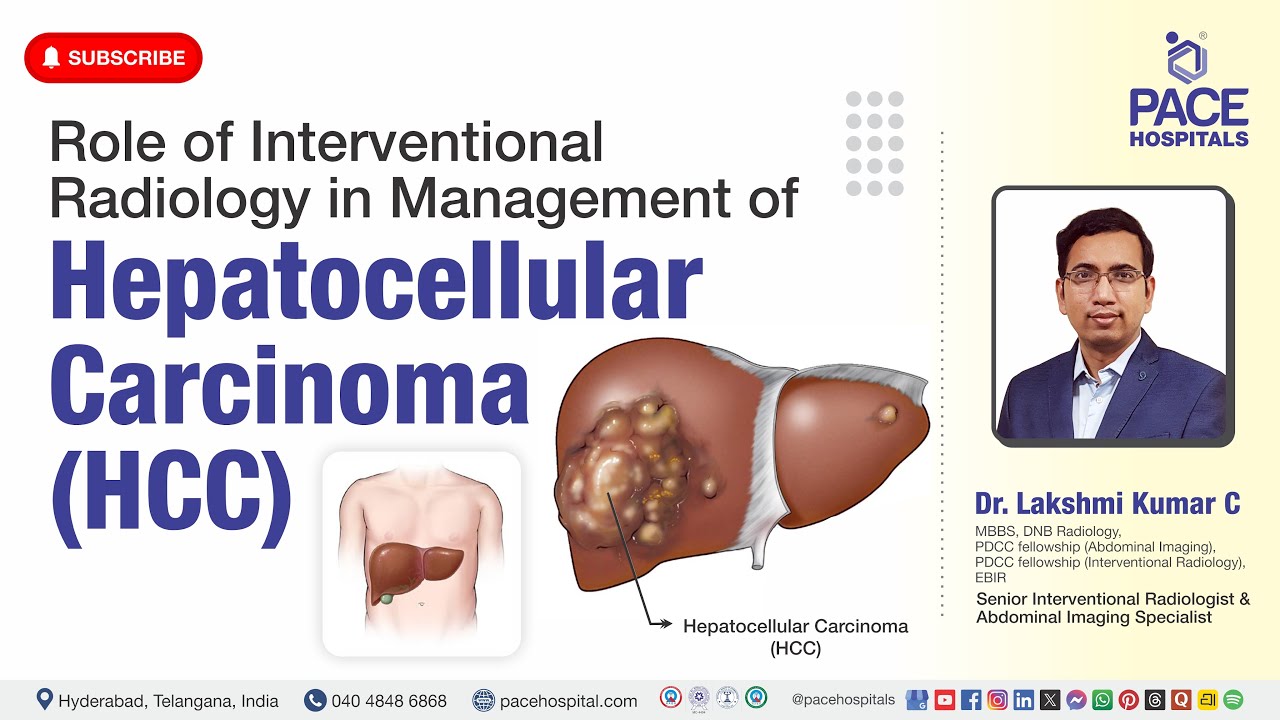 Role of Interventional Radiology in Hepatocellular Carcinoma Management | Liver Cancer Awareness