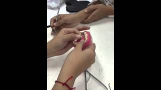Periodontal Splinting 2 ( Continuous)