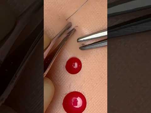 Figure-of-8 Suture 😷 #goodtoknow #suturing #stitches #vet #medicine #funfacts #surgeon #lifehacks