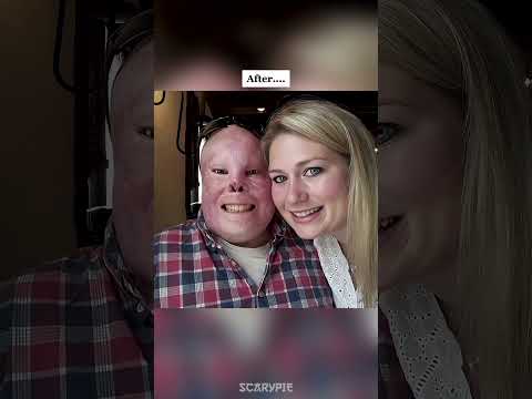 Soldiers Before VS After The War 😱 #shorts #shortsfeed