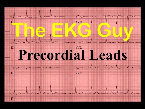 EKG/ECG Precordial Leads - Question 11.0 | The EKG Guy