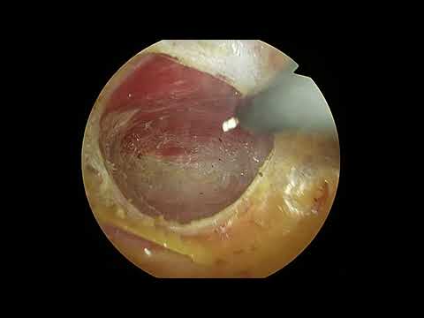 download lagu mp3 mp4 Etep, download lagu Etep gratis, unduh video klip Download Etep Mp3 dan Mp4 Unlimited Gratis