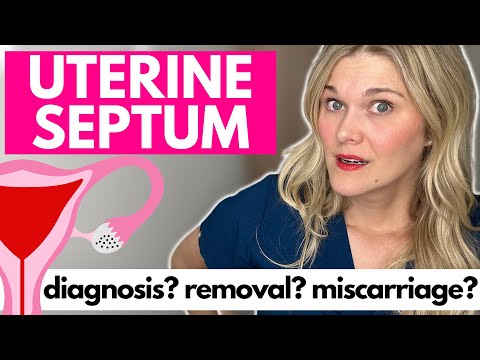 Uterine Septum: Do You Have One? What Is the Diagnosis? Should You Get A Uterine Septum Removed?