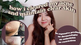 Tips on How I Cleared Acne and Maintain Clear Skin!! | thatxxRin