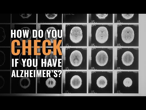 How Do You Check If You Have Alzheimer’s?