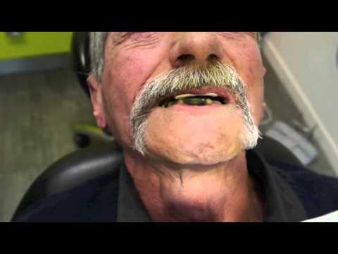 Point d'appui central 2012