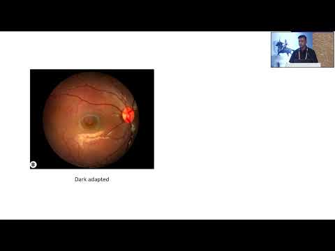 AIOCMTC4 2025 GP31 T Dr Abhishek Electrophysiology ERG and EOG for general ophthalmologists