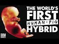 How Scientists Made The World S First Human Pig Hybrid