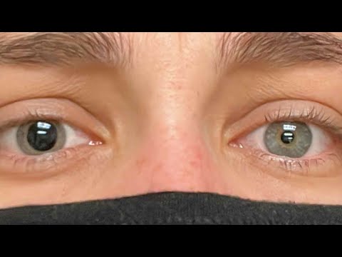 THEY NUMBED MY EYEBALLS 😭 w OnlyJayus - #Shorts