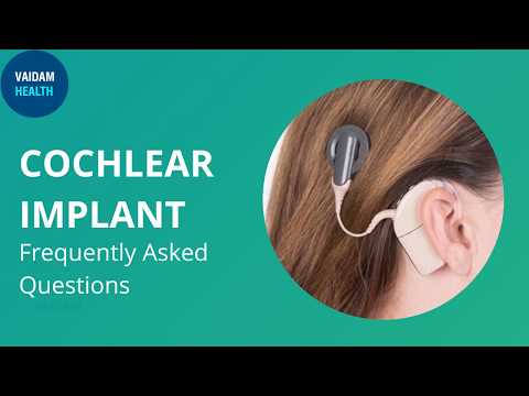 Cochlear Implant- Frequently Asked Questions