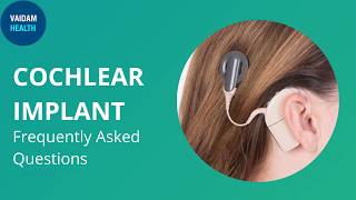 Cochlear Implant - Frequently Asked Questions