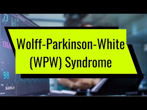 Wolff-Parkinson-White (WPW) Syndrome