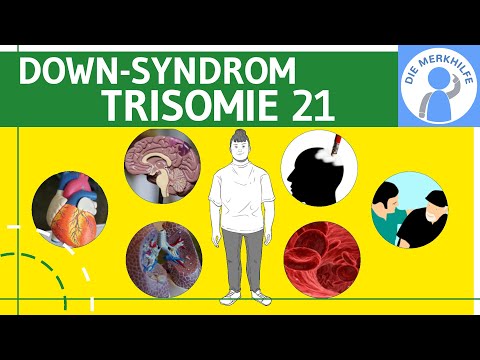 Down Syndrom / Trisomie 21 - Definition, Merkmale, Ursachen & Formen & Unterscheidungen - Genetik