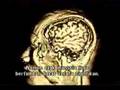 Documentary Science - Human Instinct