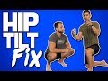 The Most Effective Way to Fix Bad Pelvic Tilt