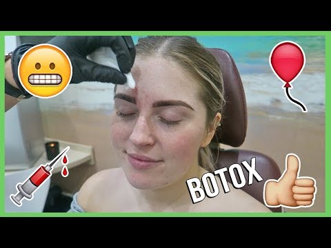 BOTOX AND XOBEAUTY 🔪 Vlog 613
