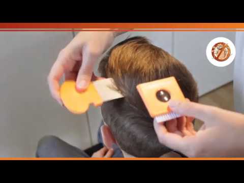 Kopfläuse-Video: Läuse  & Nissen erkennen in trockenem Haar