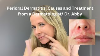 Perioral dermatitis: causes and treatment from a Dermatologist