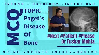 Download Lagu Paget’s Disease of Bone | INICET | FMGEE | NEET PG | NEXT #neetpg2023 #fmge #neetpg Thumbnail