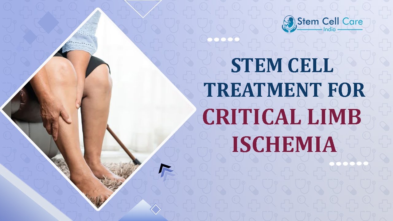 Critical Limb Ischemia | Stem Cell Treatment For Critical Limb Ischemia | Best Treatment For CLI