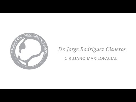 🩺Cirugía Maxilofacial en Tijuana México-Dr. Jorge Rodríguez Cisneros, más de 35 años de experiencia