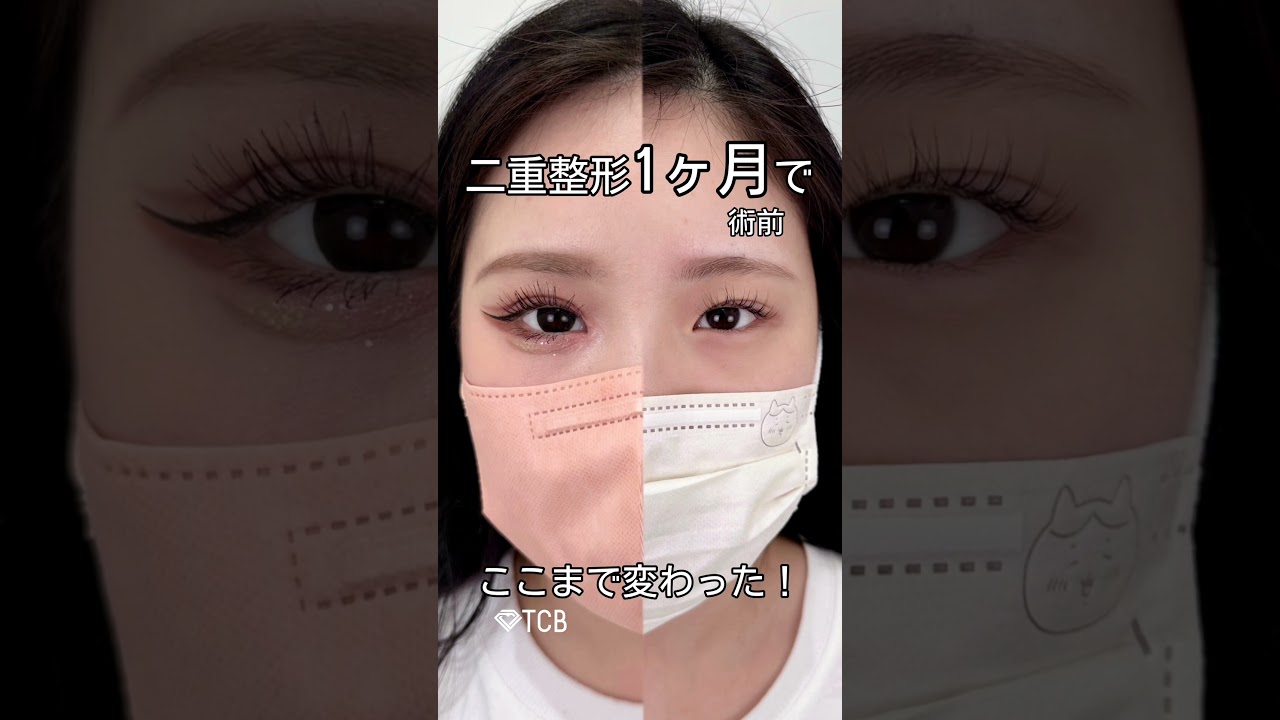 Youtubeのサムネイル