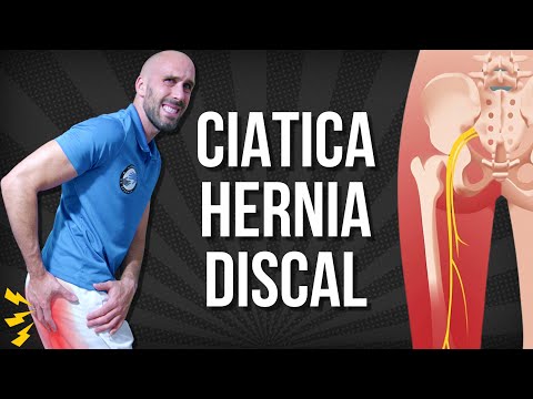 6 EJERCICIOS para la CIATICA POR HERNIA DISCAL
